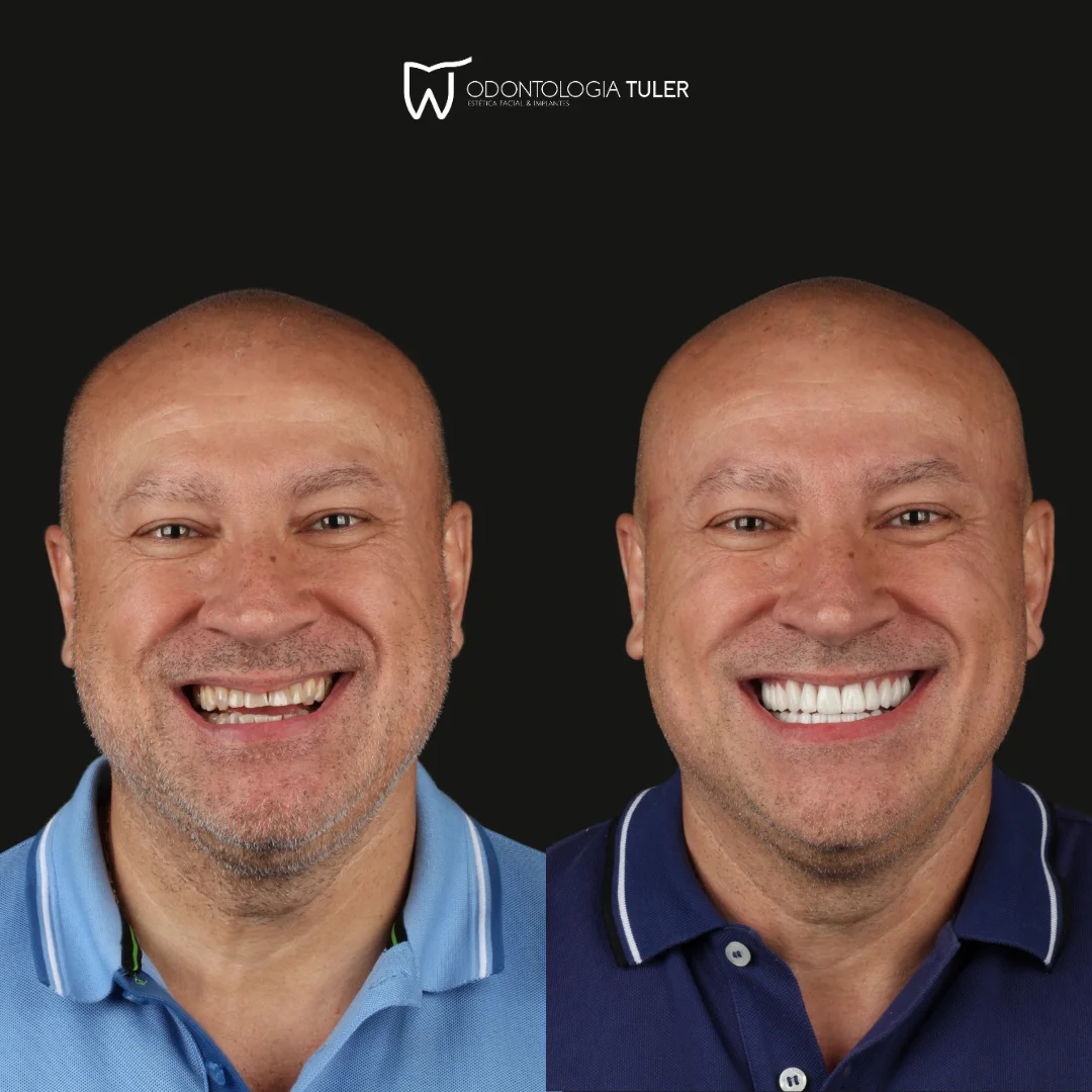 Jefferson dos santos marcelino